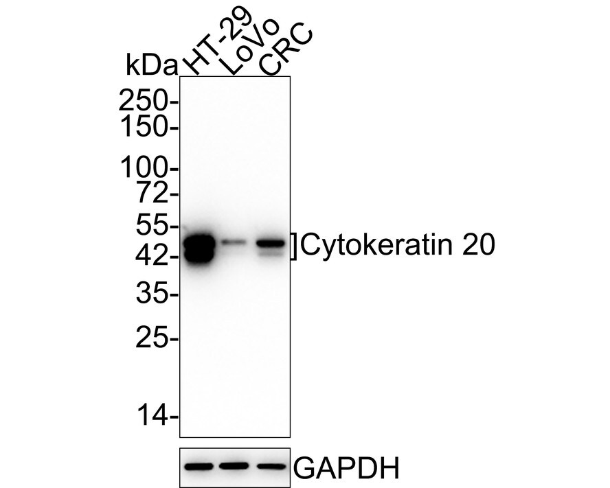 Cytokeratin 20 Antibody (SA35-03) Western Blot: Cytokeratin 20 Antibody (SA35-03) [NBP2-67309]
