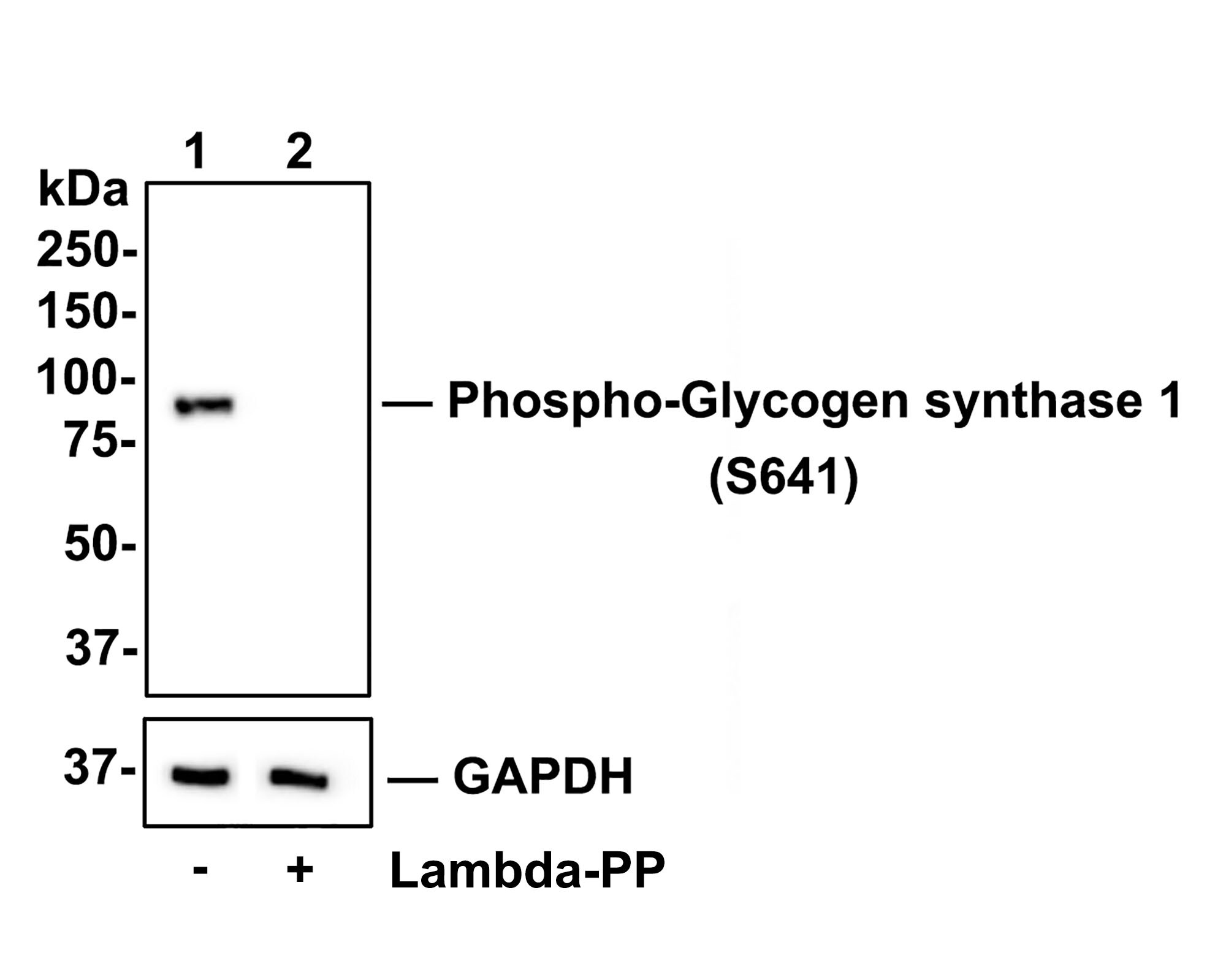 Glycogen Synthase [p Ser641] Antibody (SR46-06) Western Blot: Glycogen Synthase [p Ser641] Antibody (SR46-06) [NBP2-67315]