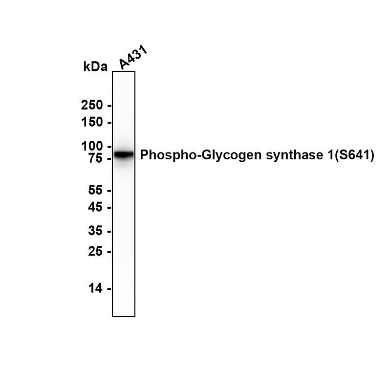 Glycogen Synthase [p Ser641] Antibody (SR46-06) Western Blot: Glycogen Synthase [p Ser641] Antibody (SR46-06) [NBP2-67315]