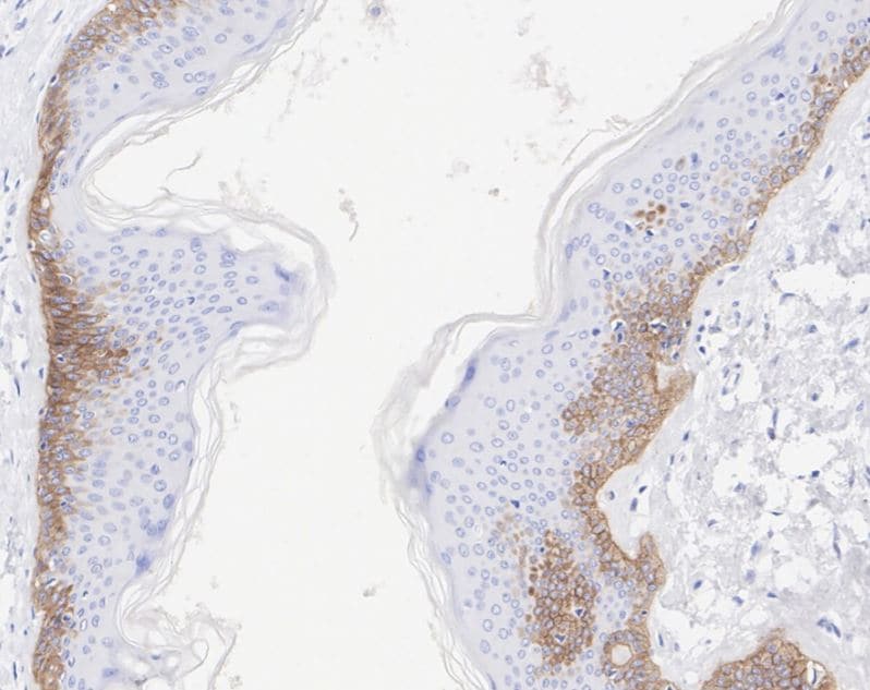 Collagen XVII Antibody (SR46-05)