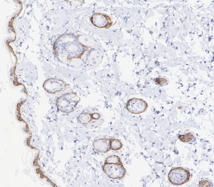 Collagen XVII Antibody (SR46-05)
