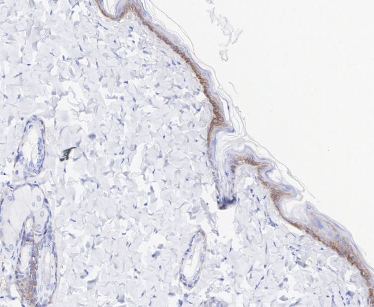 Collagen XVII Antibody (SR46-05)