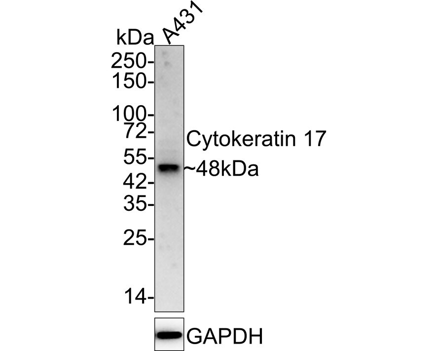 Cytokeratin 17/36 Antibody (SR45-06) Western Blot: Cytokeratin 17/36 Antibody (SR45-06) [NBP2-67318]