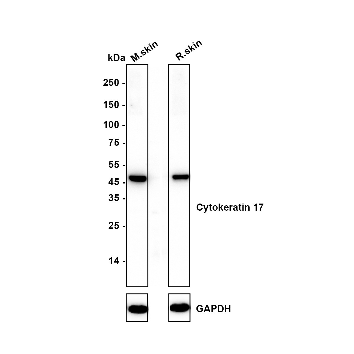 Cytokeratin 17/36 Antibody (SR45-06) Western Blot: Cytokeratin 17/36 Antibody (SR45-06) [NBP2-67318]