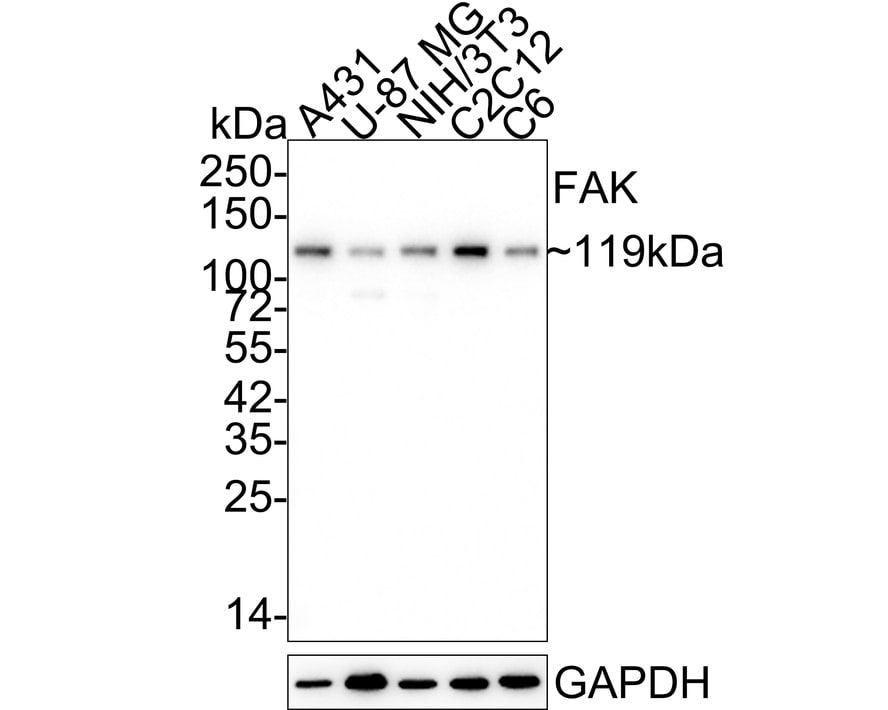 FAK Antibody (SR46-04) Western Blot: FAK Antibody (SR46-04) [NBP2-67327]