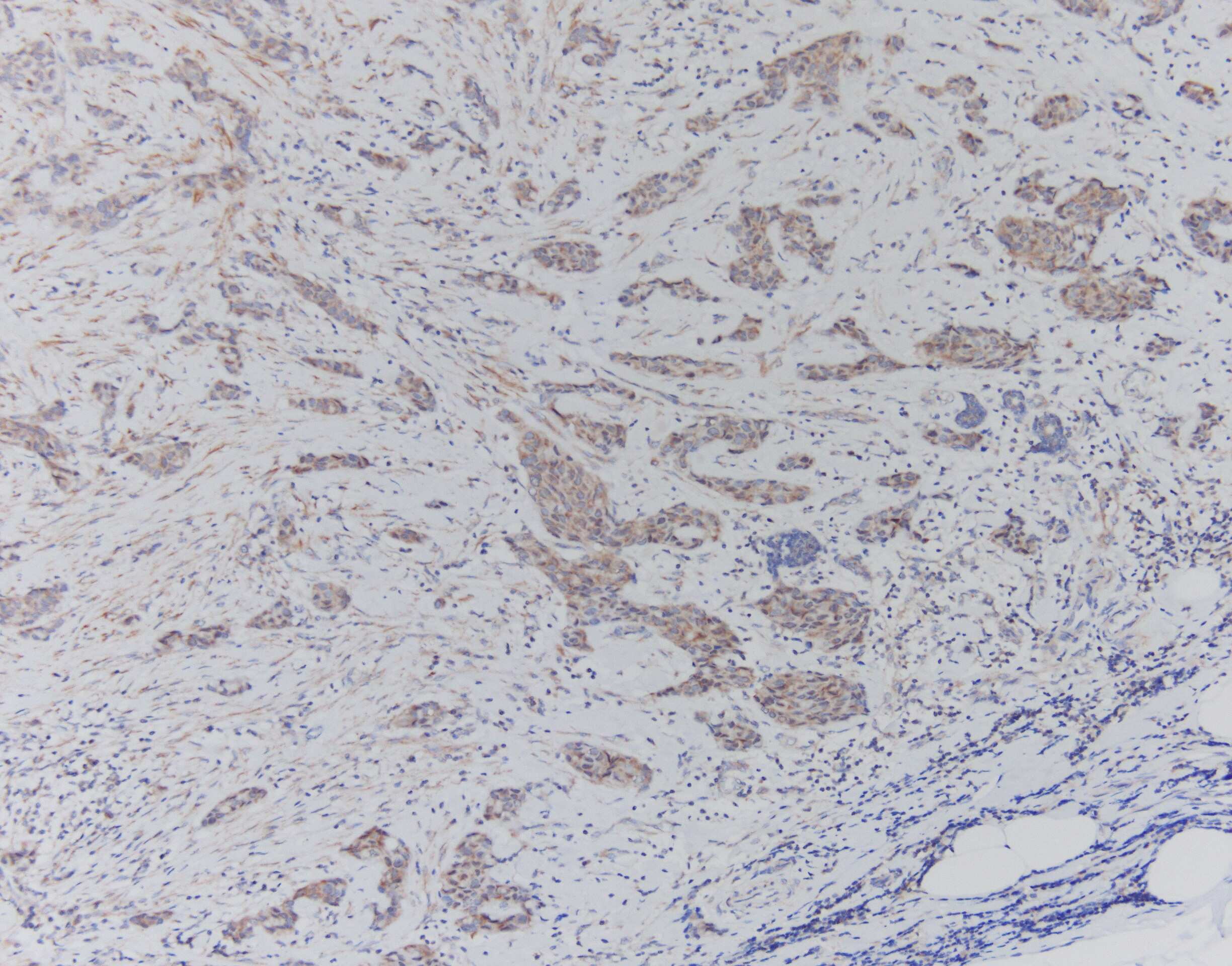 MMP-12 Antibody (SR03-23)