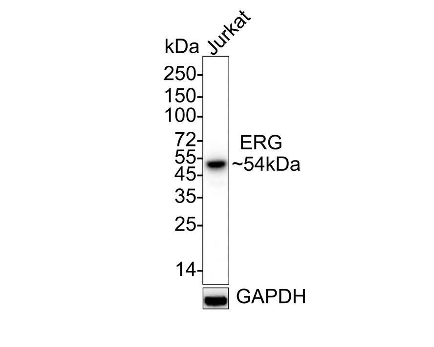 ERG Antibody (SP06-04) Western Blot: ERG Antibody (SP06-04) [NBP2-67375]