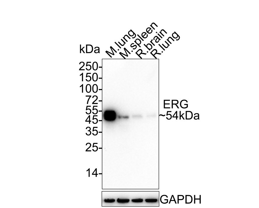 ERG Antibody (SP06-04) Western Blot: ERG Antibody (SP06-04) [NBP2-67375]