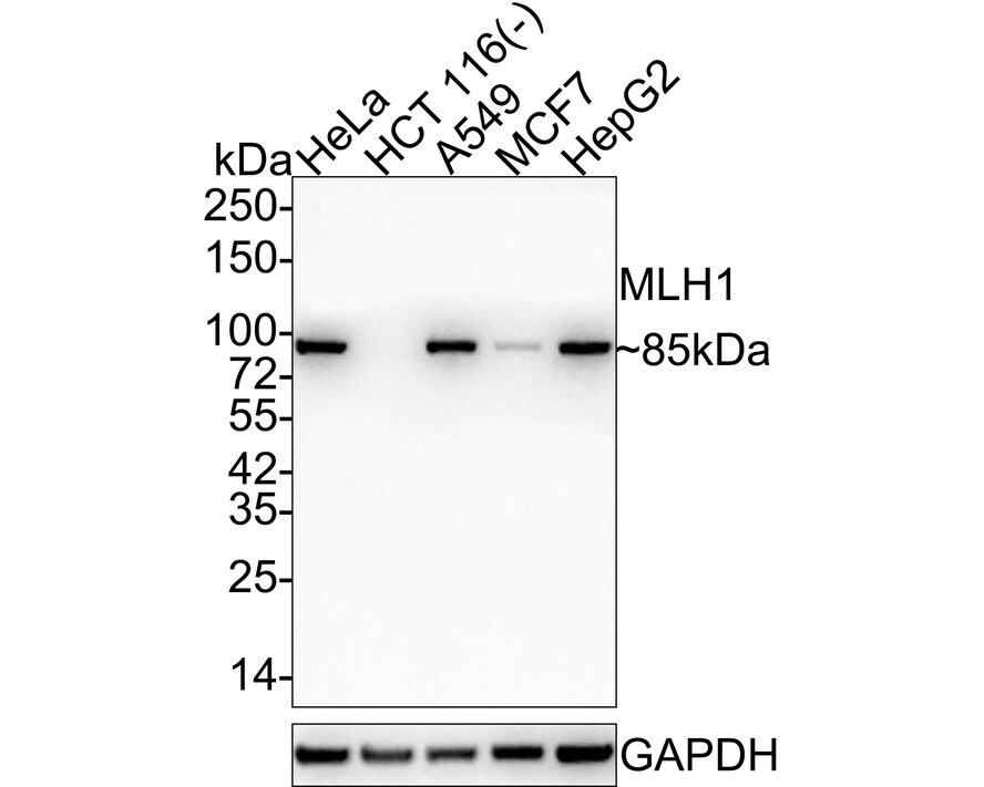 MLH1 Antibody (SP08-04) Western Blot: MLH1 Antibody (SP08-04) [NBP2-67381]