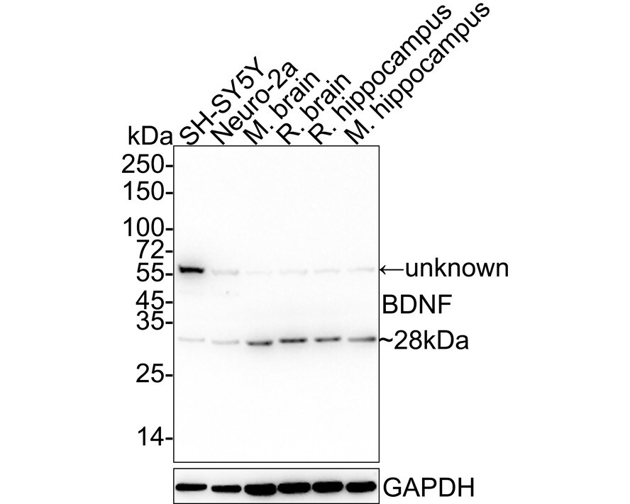 BDNF Antibody (SJ12-09) Western Blot: BDNF Antibody (SJ12-09) [NBP2-67410]