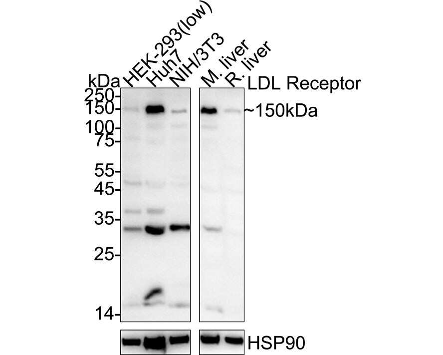 LDLR Antibody (SJ0197) Western Blot: LDLR Antibody (SJ0197) [NBP2-67414]