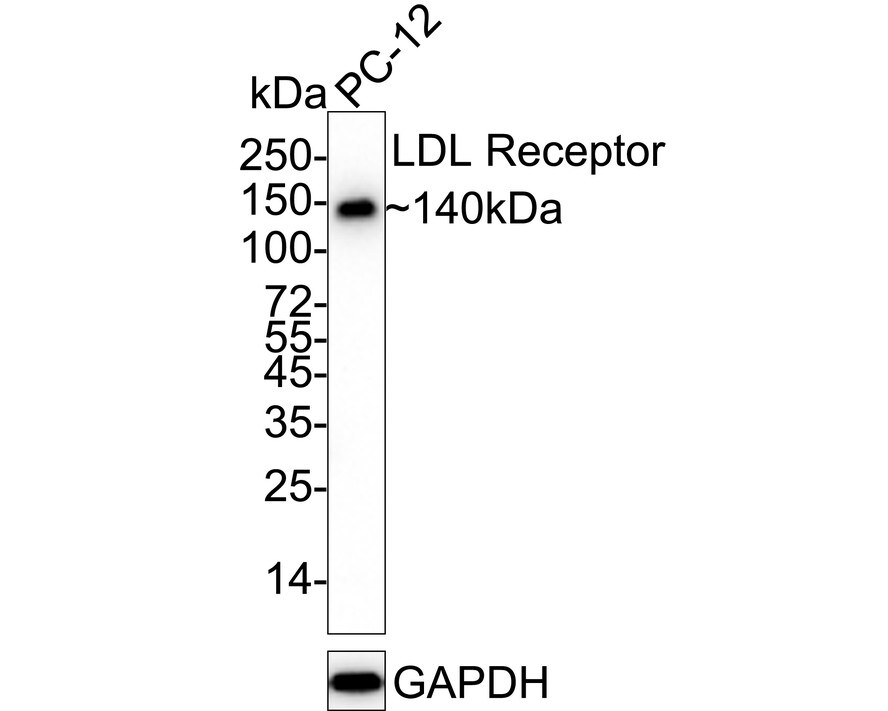 LDLR Antibody (SJ0197) Western Blot: LDLR Antibody (SJ0197) [NBP2-67414]