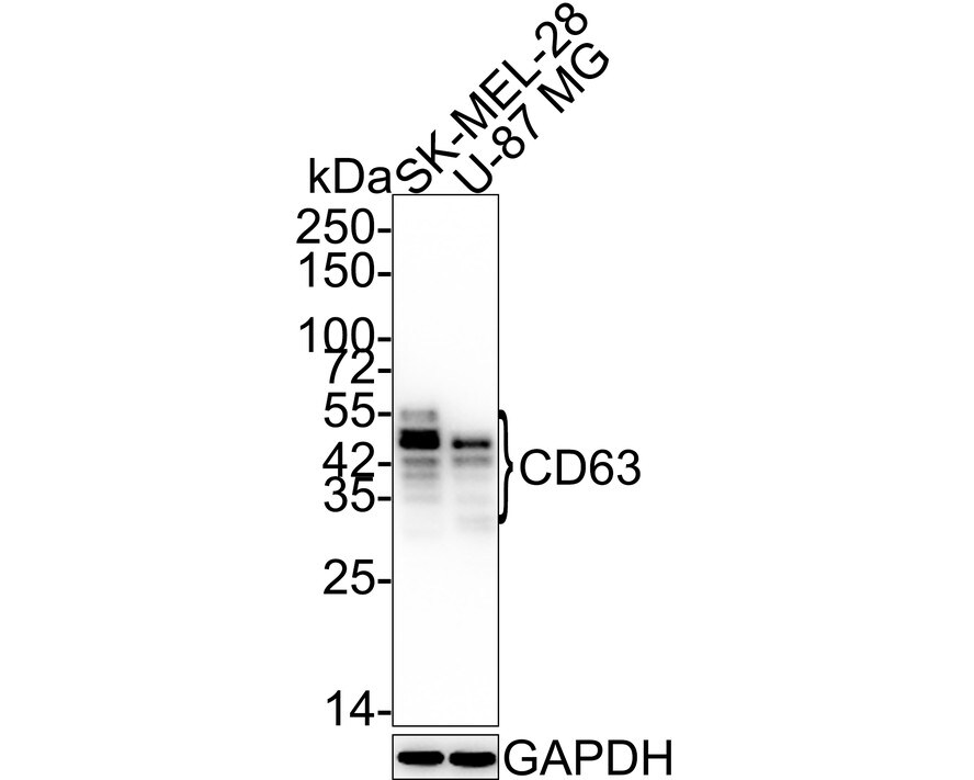 CD63 Antibody (SY21-02) Western Blot: CD63 Antibody (SY21-02) [NBP2-67425]