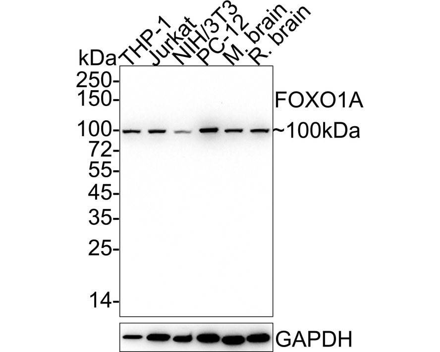 FoxO1/FKHR Antibody (SU33-01) Western Blot: FoxO1/FKHR Antibody (SU33-01) [NBP2-67463]