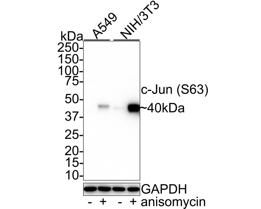 c-jun [p Ser63] Antibody (SY0297) Western Blot: c-jun [p Ser63] Antibody (SY0297) [NBP2-67471]