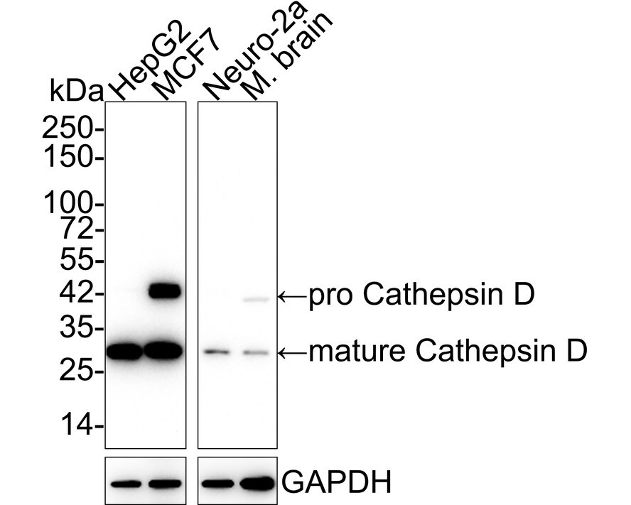 Cathepsin D Antibody (SU0360) Western Blot: Cathepsin D Antibody (SU0360) [NBP2-67477]