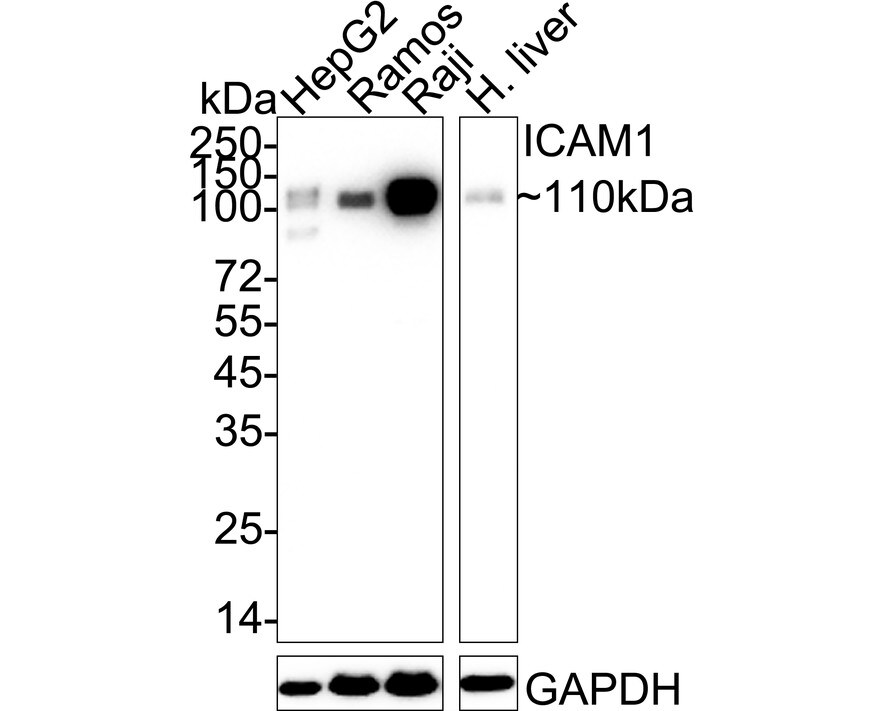 ICAM-1/CD54 Antibody (ST0487) Western Blot: ICAM-1/CD54 Antibody (ST0487) [NBP2-67518]