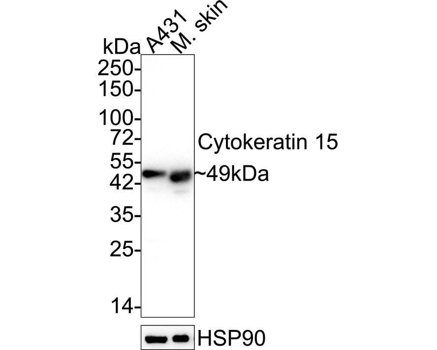 Cytokeratin 15 Antibody (ST04-85) Western Blot: Cytokeratin 15 Antibody (ST04-85) [NBP2-67525]