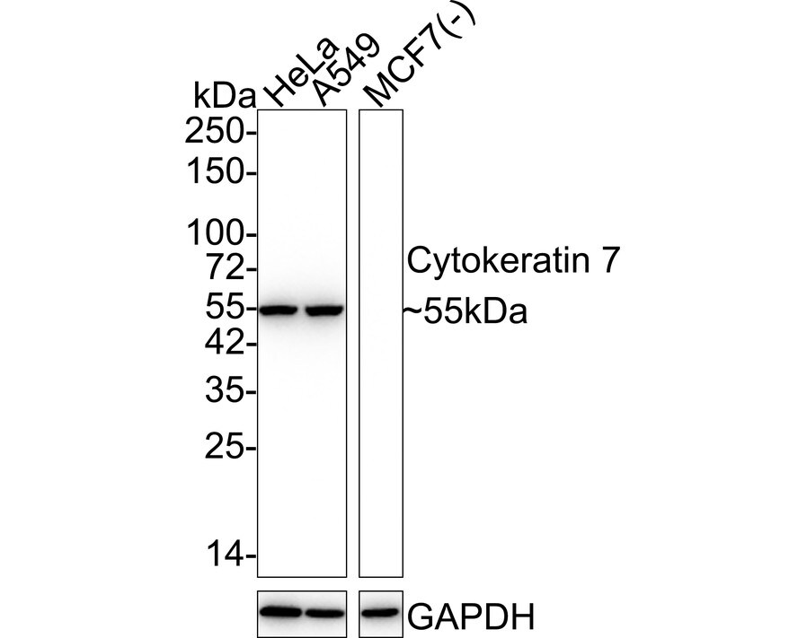 Cytokeratin 7/13/17/18 Antibody (ST50-05) Western Blot: Cytokeratin 7/13/17/18 Antibody (ST50-05) [NBP2-67533]