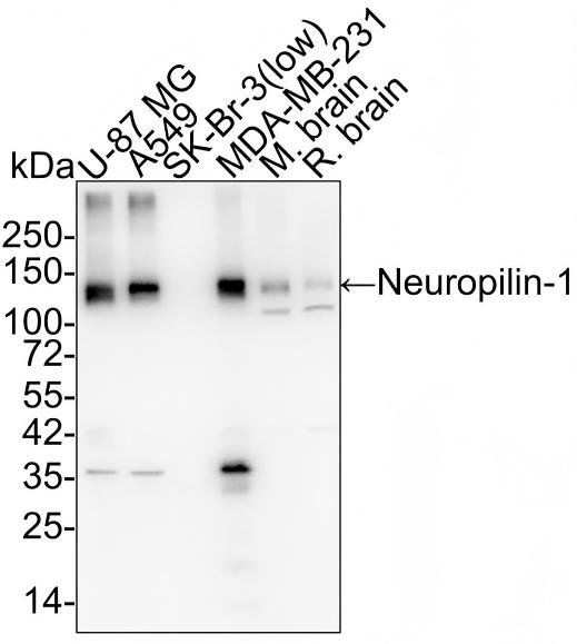 Neuropilin-1 Antibody (ST05-30) Western Blot: Neuropilin-1 Antibody (ST05-30) [NBP2-67539]