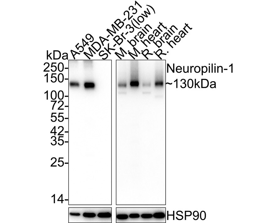 Neuropilin-1 Antibody (ST05-30) Western Blot: Neuropilin-1 Antibody (ST05-30) [NBP2-67539]