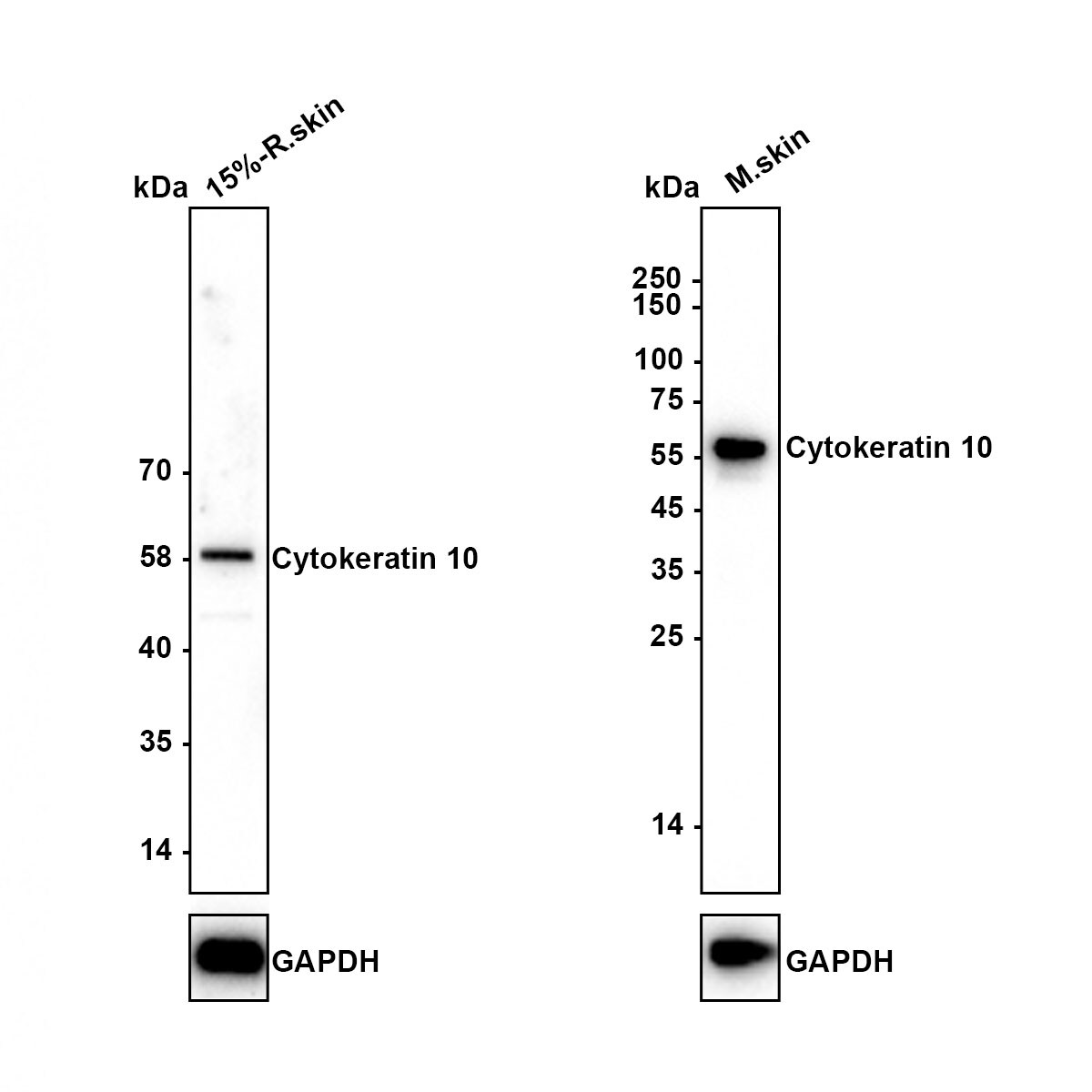 Cytokeratin 1/10 Antibody (ST05-43) Western Blot: Cytokeratin 1/10 Antibody (ST05-43) [NBP2-67544]