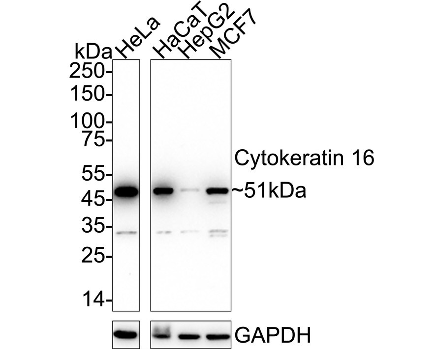 Cytokeratin 16 Antibody (SC52-09) Western Blot: Cytokeratin 16 Antibody (SC52-09) [NBP2-67559]