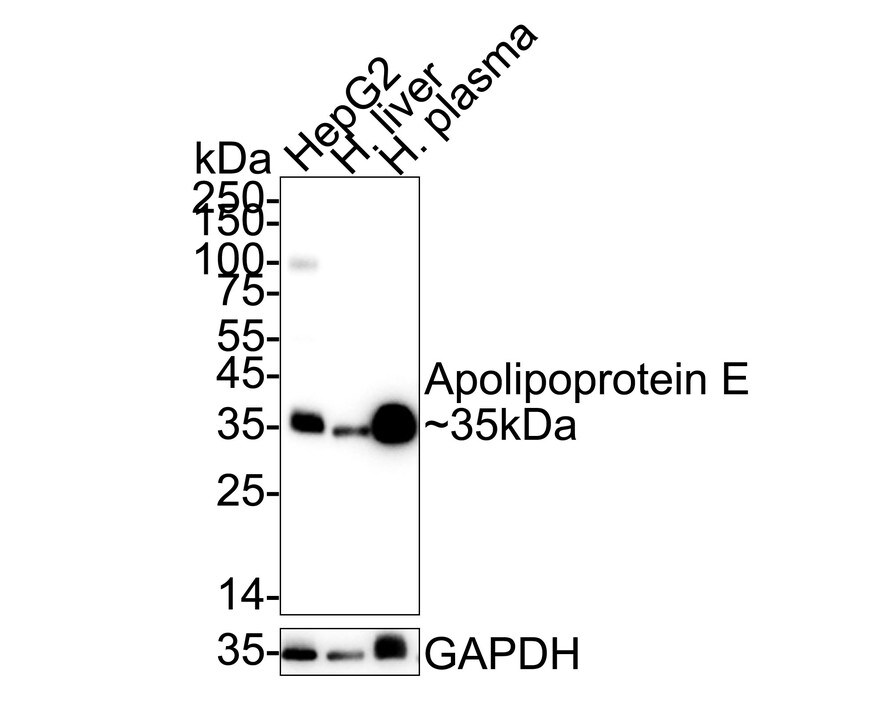 Apolipoprotein E/ApoE Antibody (SC0536) Western Blot: Apolipoprotein E/ApoE Antibody (SC0536) [NBP2-67565]