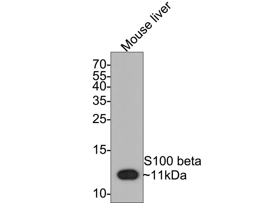 S100B Antibody (SC57-02) Western Blot: S100B Antibody (SC57-02) [NBP2-67572]