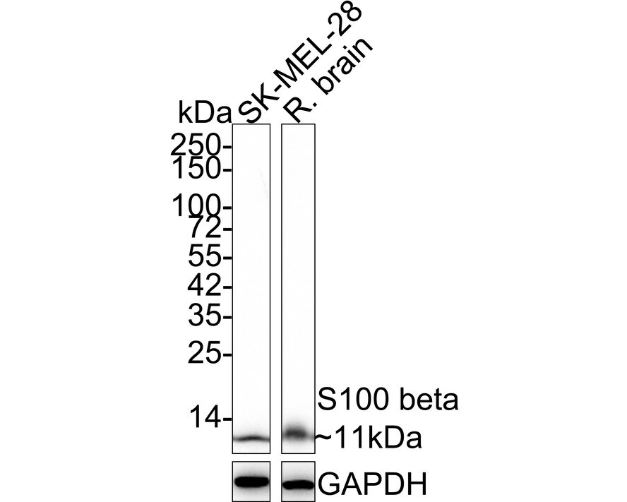 S100B Antibody (SC57-02) Western Blot: S100B Antibody (SC57-02) [NBP2-67572]