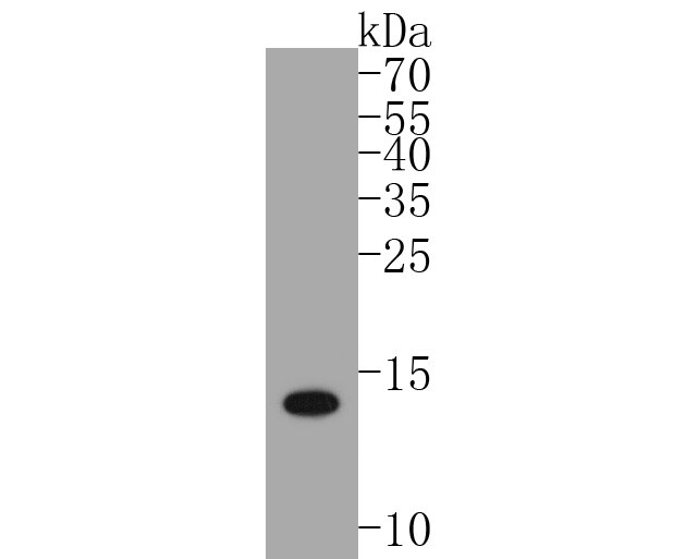 S100B Antibody (SC57-02) Western Blot: S100B Antibody (SC57-02) [NBP2-67572]