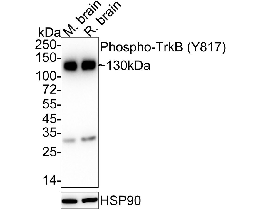 TrkB [p Tyr817] Antibody (SC0556) Western Blot: TrkB [p Tyr817] Antibody (SC0556) [NBP2-67578]