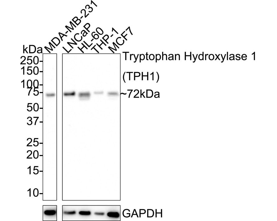 Tryptophan Hydroxylase 1/TPH-1 Antibody (SC53-07) Western Blot: Tryptophan Hydroxylase 1/TPH-1 Antibody (SC53-07) [NBP2-67580]