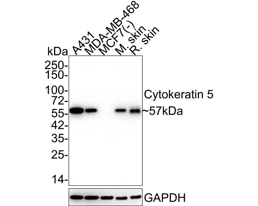Cytokeratin 5/75 Antibody (SC62-04) Western Blot: Cytokeratin 5/75 Antibody (SC62-04) [NBP2-67586]