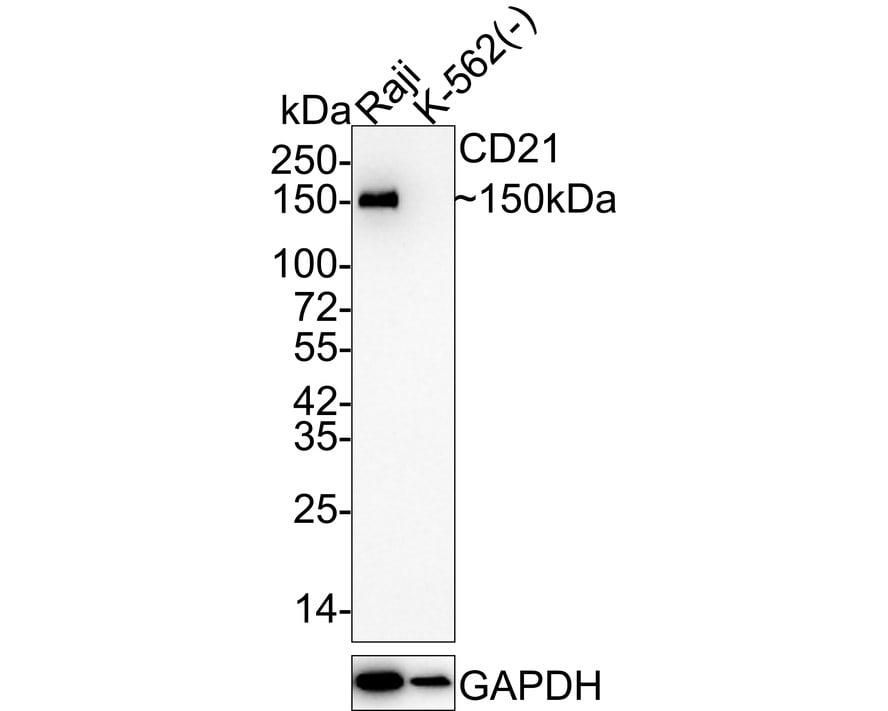 CD21 Antibody (SC0681) Western Blot: CD21 Antibody (SC0681) [NBP2-67605]