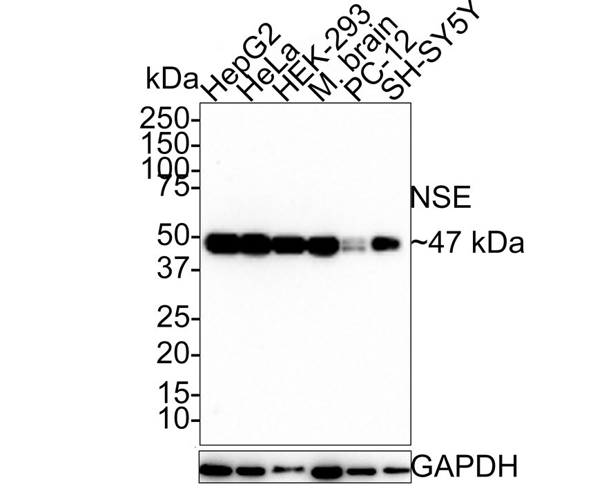 Enolase 2/Neuron-specific Enolase Antibody (SC06-28) Western Blot: Enolase 2/Neuron-specific Enolase Antibody (SC06-28) [NBP2-67641]