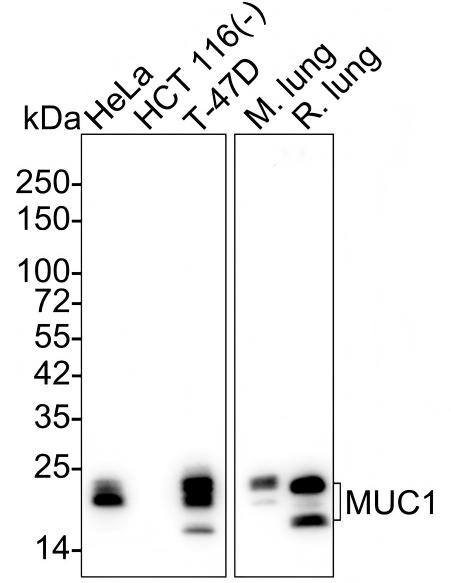 MUC1 Antibody (SN06-80) Western Blot: MUC1 Antibody (SN06-80) [NBP2-67650]