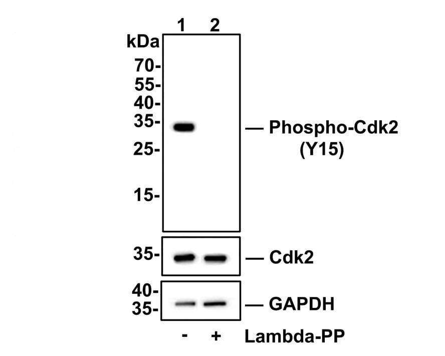 CDK2 [p Tyr15] Antibody (SN72-04) Western Blot: CDK2 [p Tyr15] Antibody (SN72-04) [NBP2-67686]