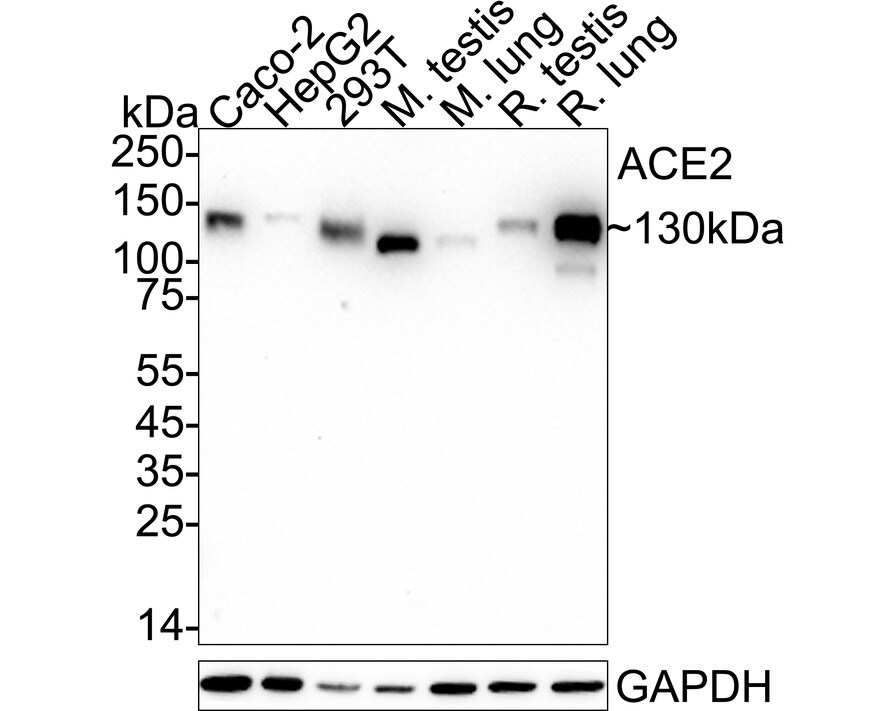 ACE-2 Antibody (SN0754) Western Blot: ACE-2 Antibody (SN0754) [NBP2-67692]