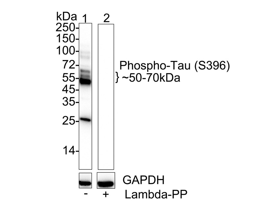 Tau [p Ser396] Antibody (SN62-09) Western Blot: Tau [p Ser396] Antibody (SN62-09) [NBP2-67702]