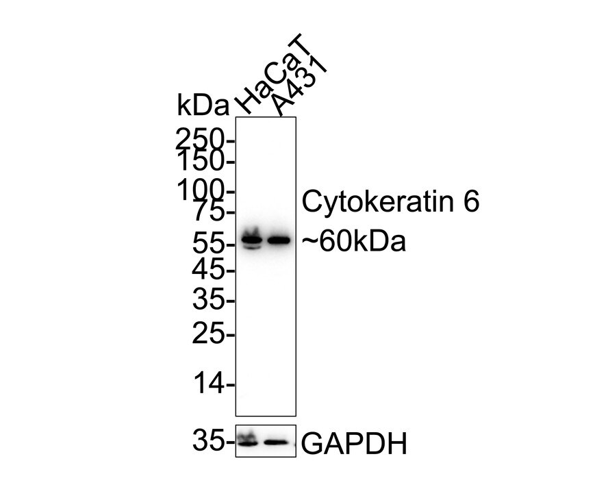 Cytokeratin 6a Antibody (SN71-07) Western Blot: Cytokeratin 6a Antibody (SN71-07) [NBP2-67705]