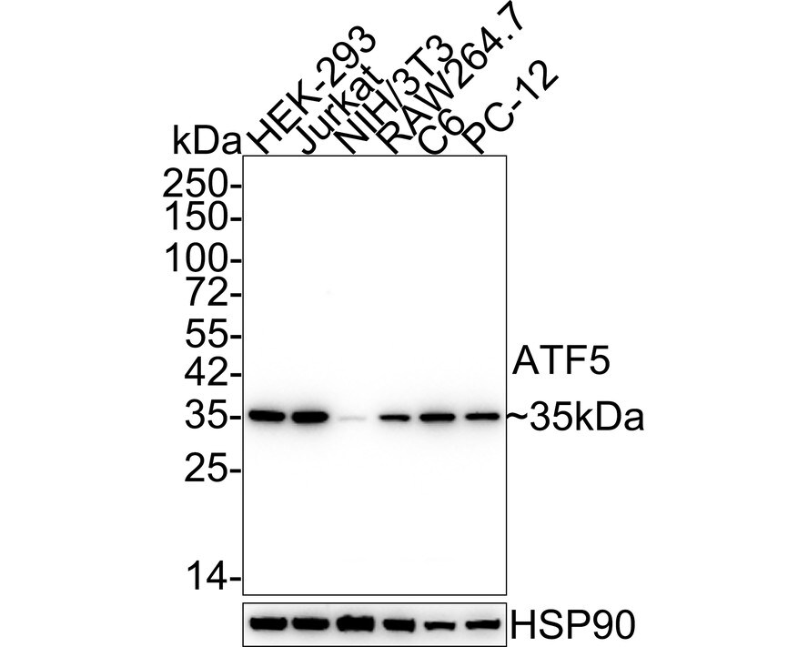 ATF5 Antibody (SD2099) Western Blot: ATF5 Antibody (SD2099) [NBP2-67767]