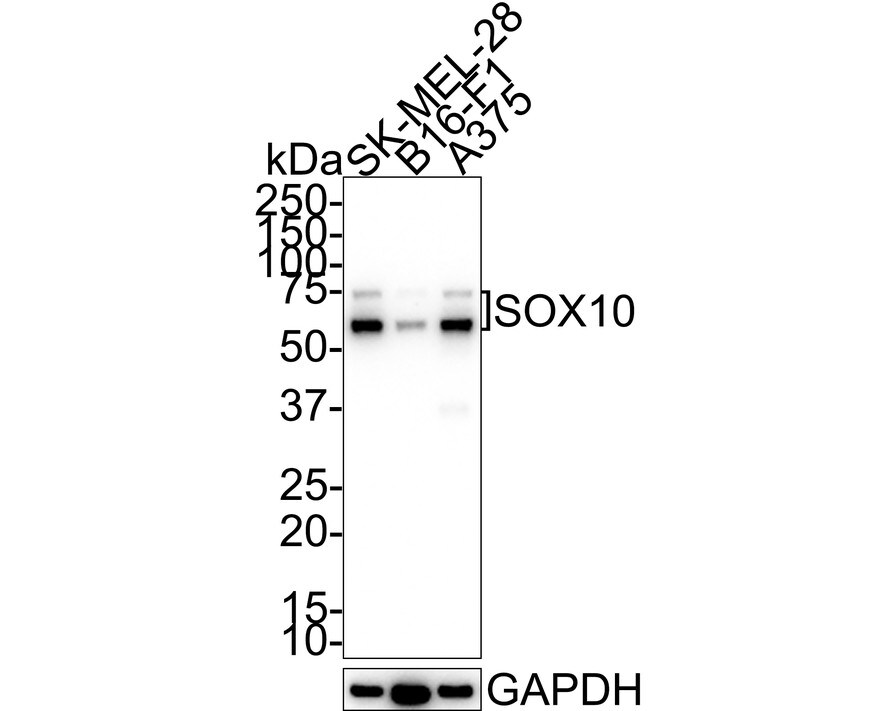 SOX10 Antibody (SD204-04) Western Blot: SOX10 Antibody (SD204-04) [NBP2-67812]