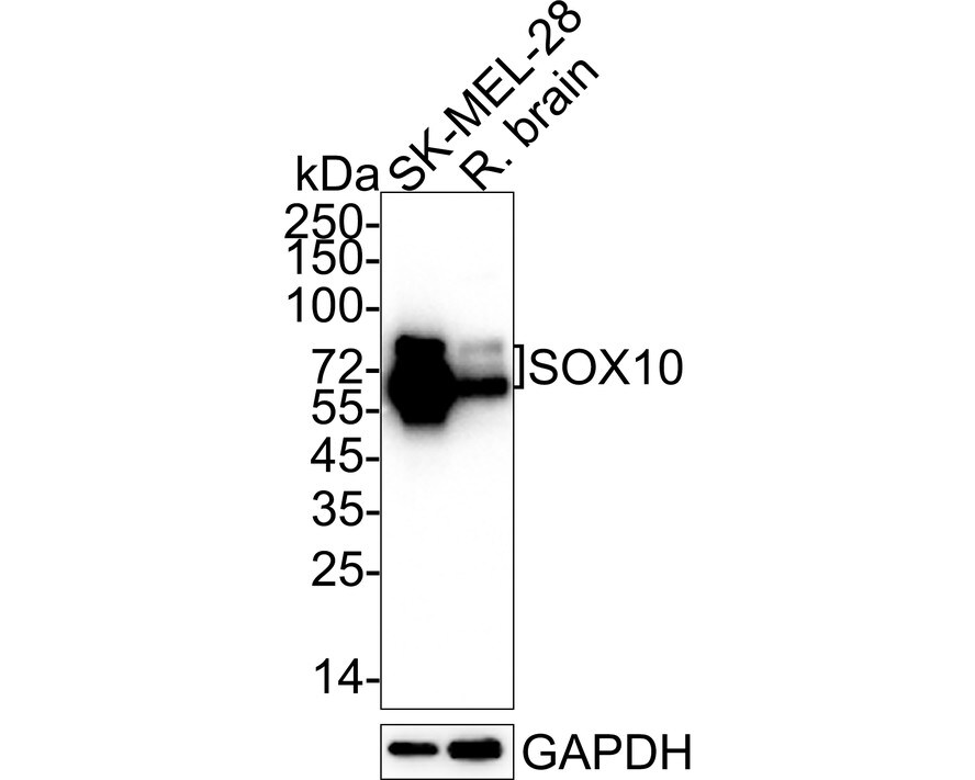SOX10 Antibody (SD204-04) Western Blot: SOX10 Antibody (SD204-04) [NBP2-67812]