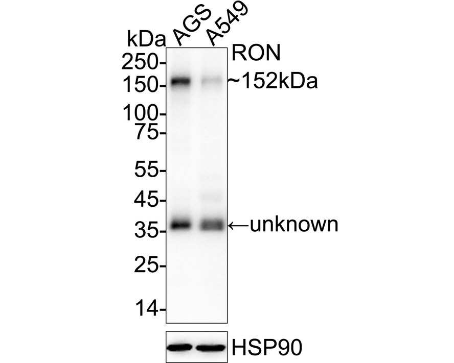 MSPR/Ron Antibody (SD2006) Western Blot: MSPR/Ron Antibody (SD2006) [NBP2-67814]