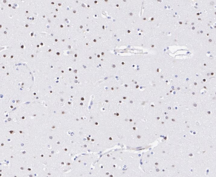 SOX1 Antibody (JJ20-40)