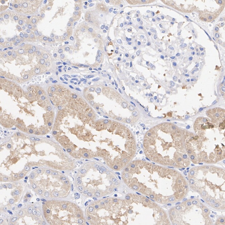FAT10 Antibody (JJ084-09)