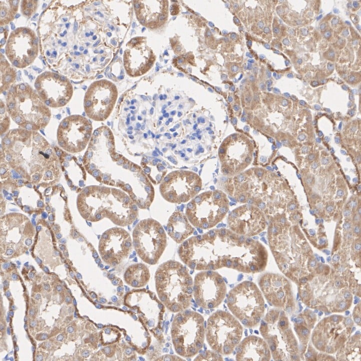 FAT10 Antibody (JJ084-09)