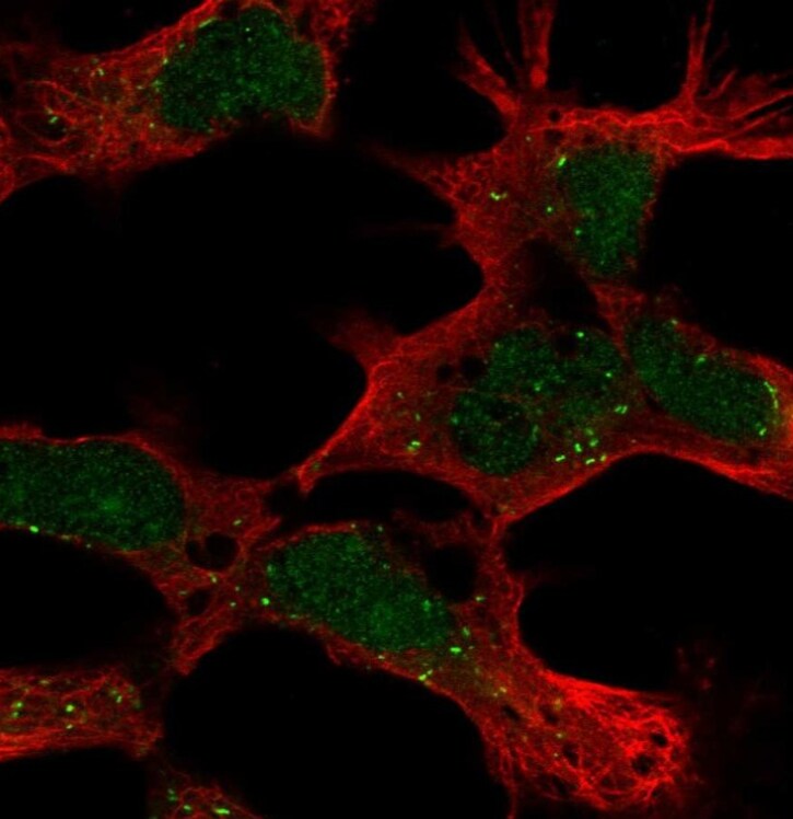 PHF14 Antibody - BSA Free