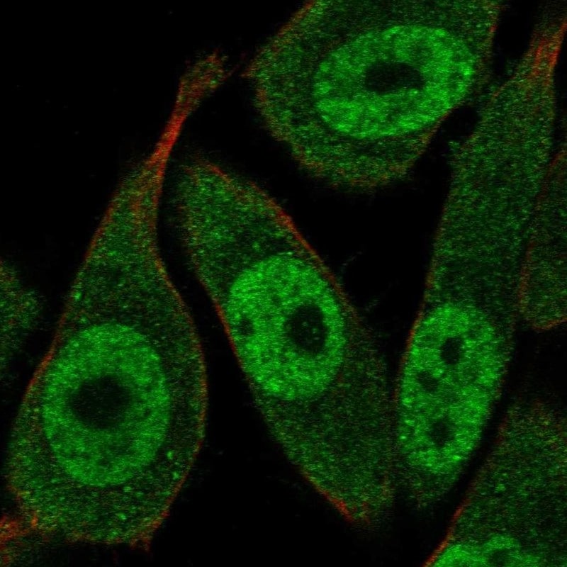 HR23A/Rad23A TUBE1 Antibody - BSA Free Immunocytochemistry/ Immunofluorescence: HR23A/Rad23A TUBE1 Antibody [NBP2-68598]